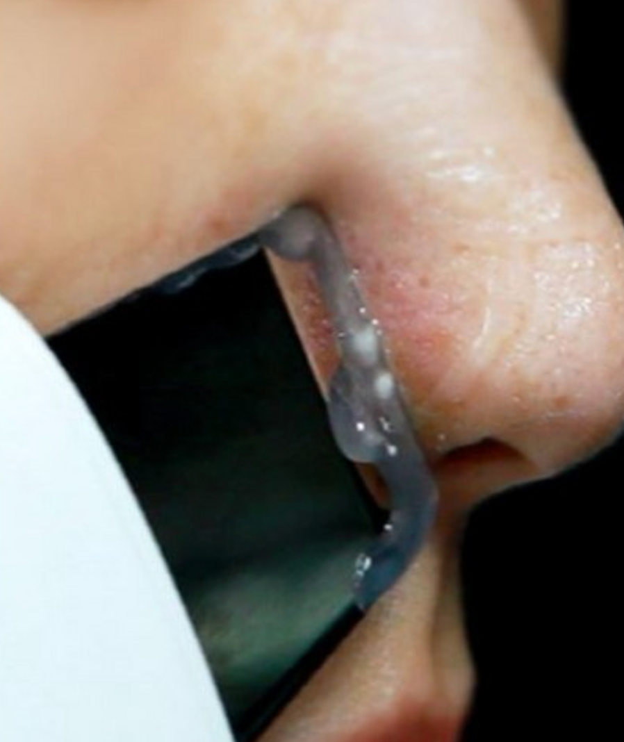 Face Factory Zero Peeling Device