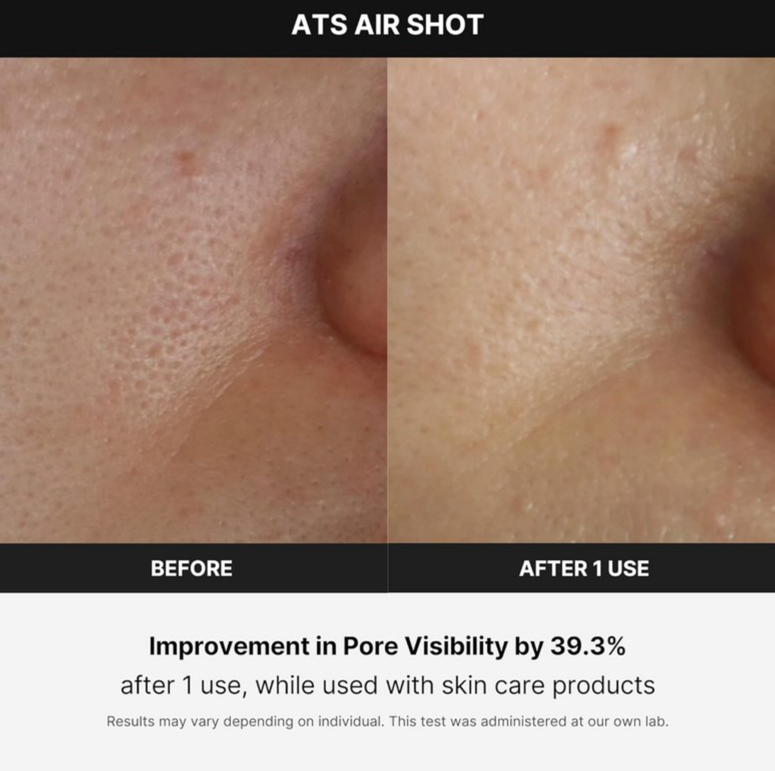 Medicube Age-R ATS Air Shot - Advanced Skincare Device for Professional Results at Home