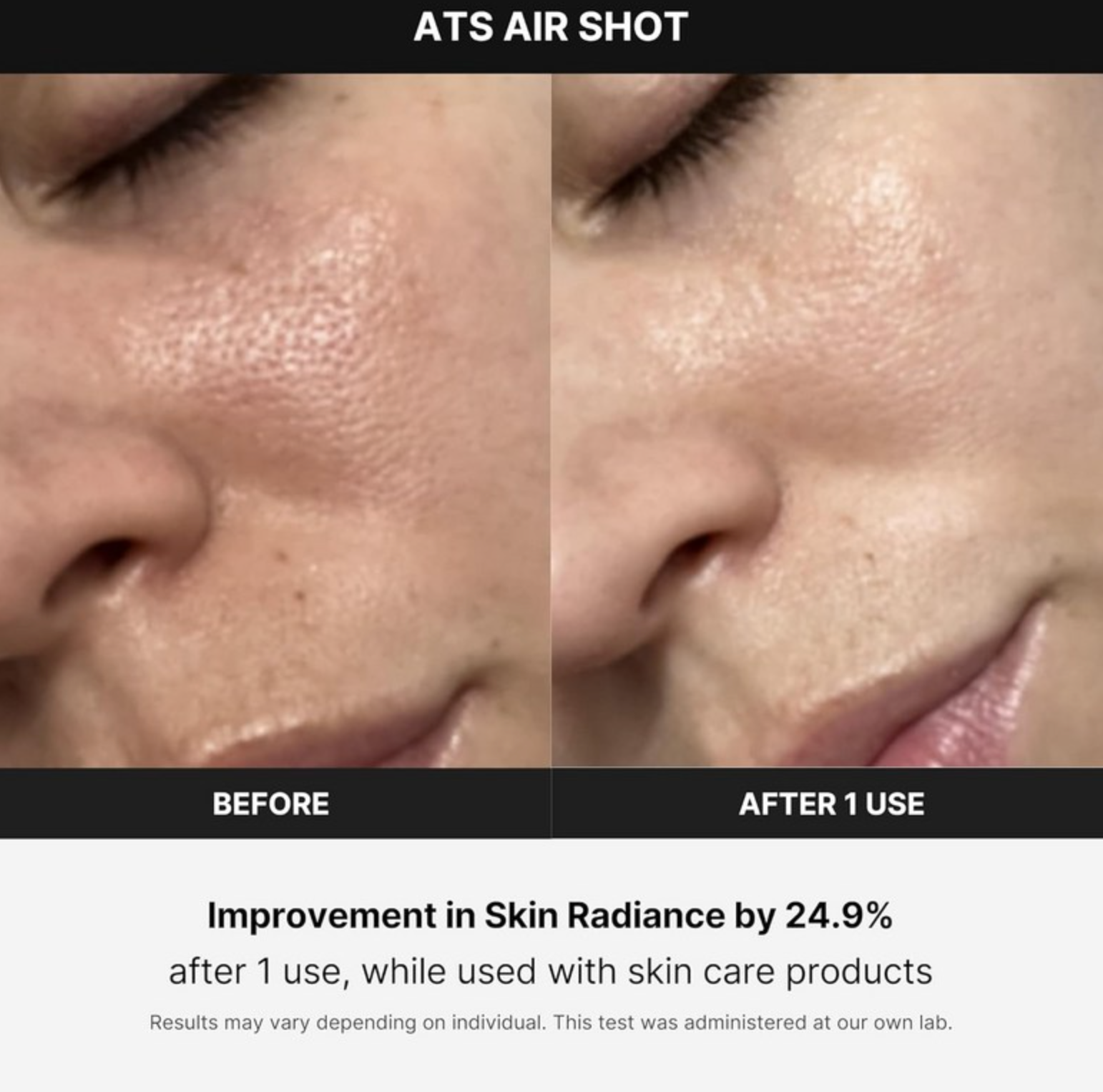 Medicube Age-R ATS Air Shot - Advanced Skincare Device for Professional Results at Home