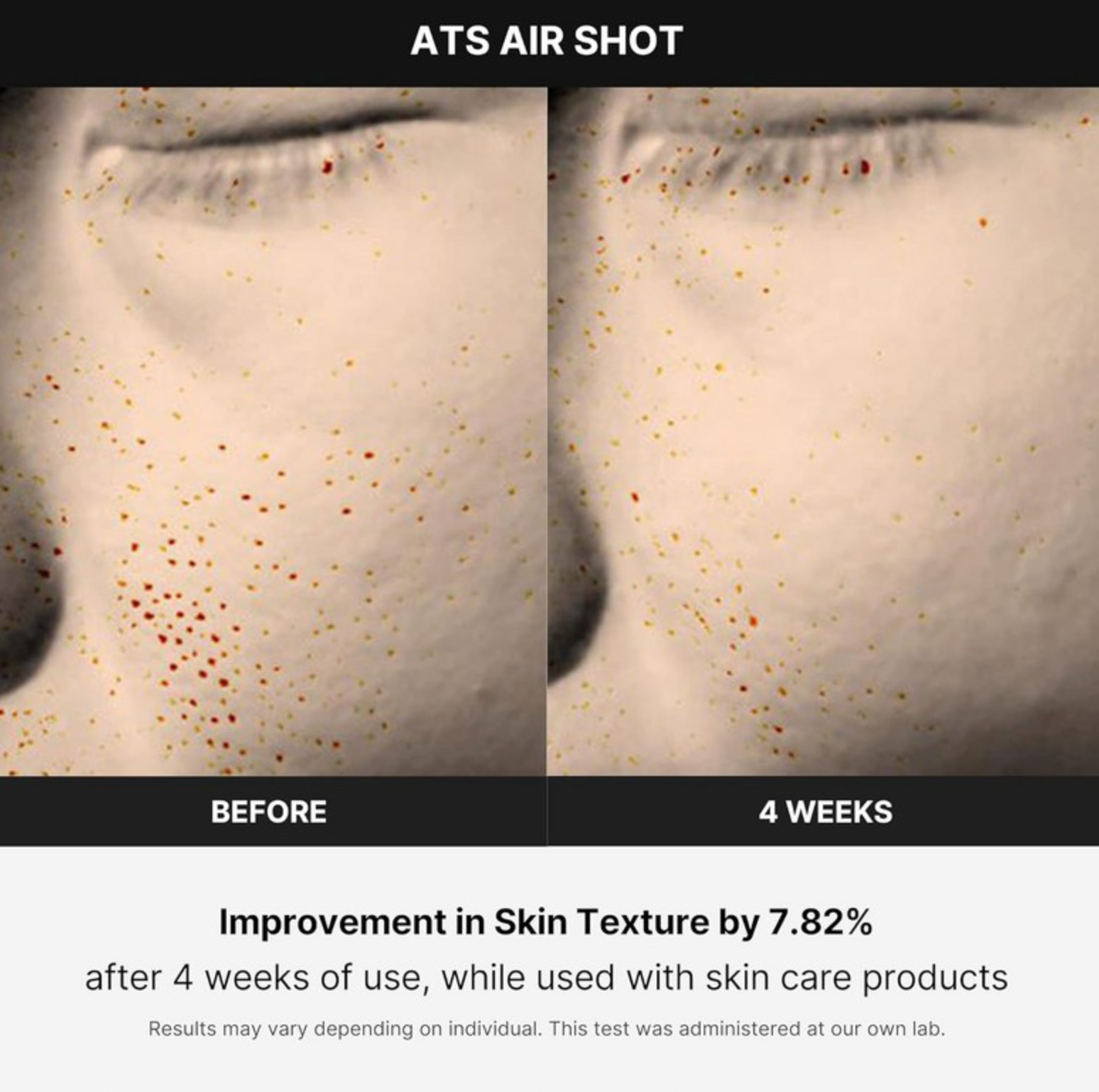 Medicube Age-R ATS Air Shot - Advanced Skincare Device for Professional Results at Home