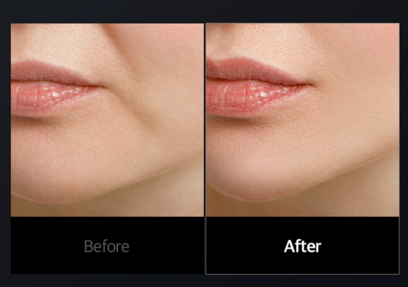 Cellology CELLNEWMER Iron – Advanced Facial Sculpting & Lifting Device (Professional Skin Rejuvenation at Home)