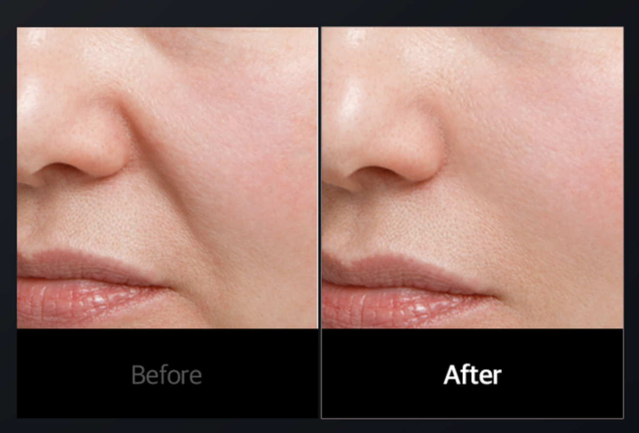 Cellology CELLNEWMER Iron – Advanced Facial Sculpting & Lifting Device (Professional Skin Rejuvenation at Home)