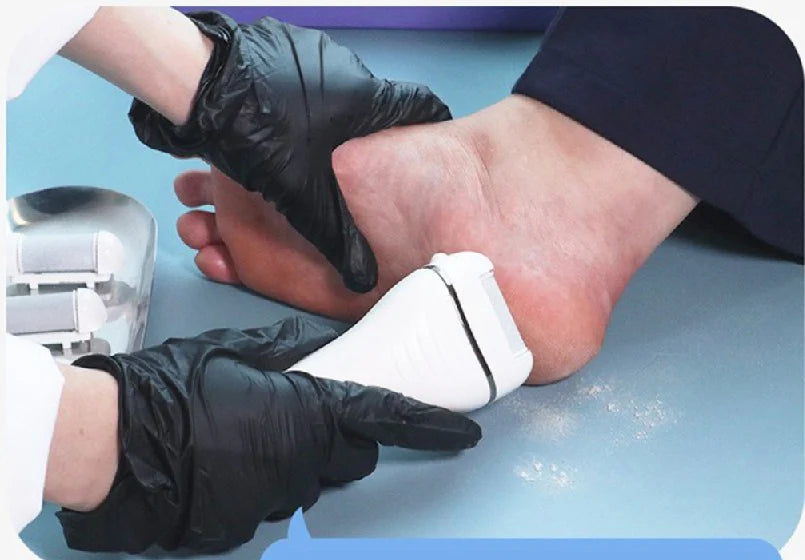 Face Factory FF-17 Rechargeable Electric Foot Callus Remover