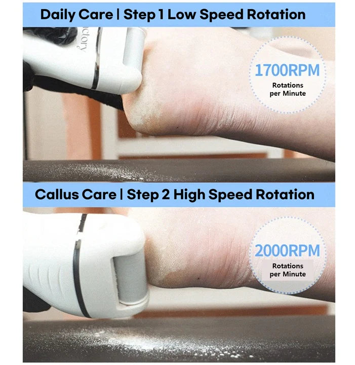 Face Factory FF-17 Rechargeable Electric Foot Callus Remover
